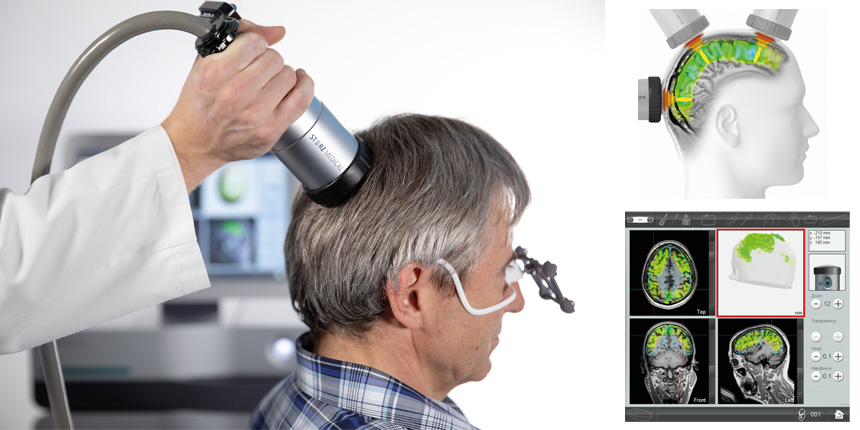 The Science Behind Medical Breakthroughs: Insights from Experts